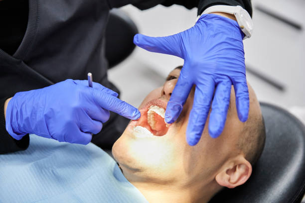 Best Emergency Dental Care for Broken or Chipped Teeth in Gassville, AR